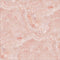 Crystal Pink Cochlear Nucleus 6 Skin